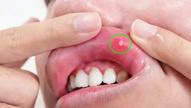 B Vitamini Eksikliği Neden Bu Kadar Tehlikeli? 5 Belirgin Belirtiyi Kaçırmayın!