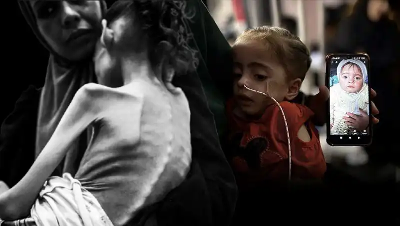 25 Kilodan 10 Kiloya Düşen Meryem’in Açlıkla Mücadelesi Tüm Türkiye’yi Şaşkına Çevirdi