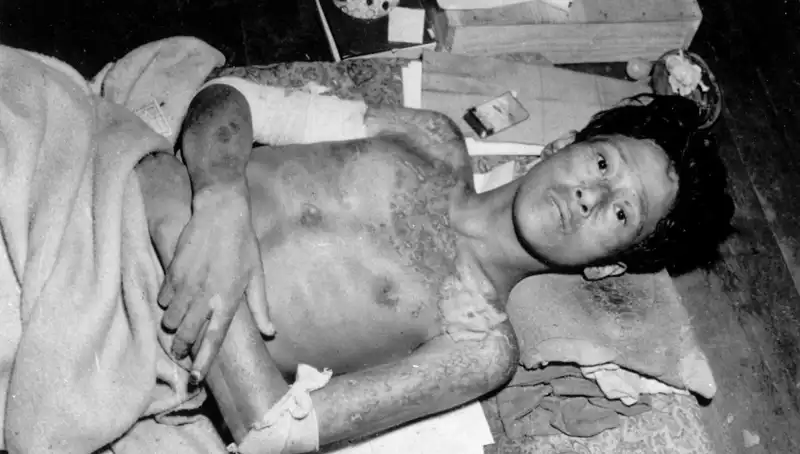 80 Yıl Sonra Nagasaki’den Uyarı: Nükleer Felaket Tehdidi Yeniden Gündemde