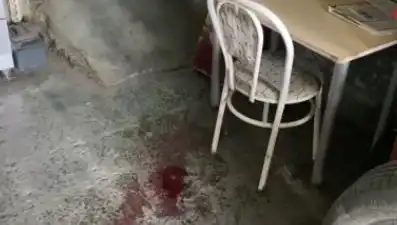Sandalyeden Düşen Adamın Yaşadığı Korkunç Kaza Türkiye'yi Sarstı